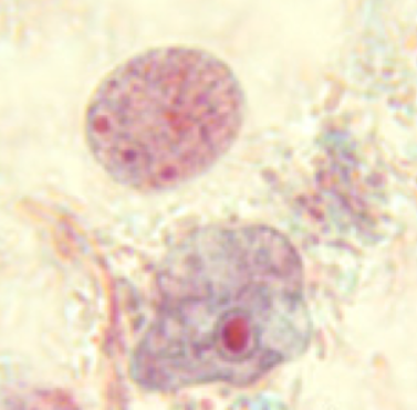 <p>Identify the organism based on their trophozoite and cyst forms</p>