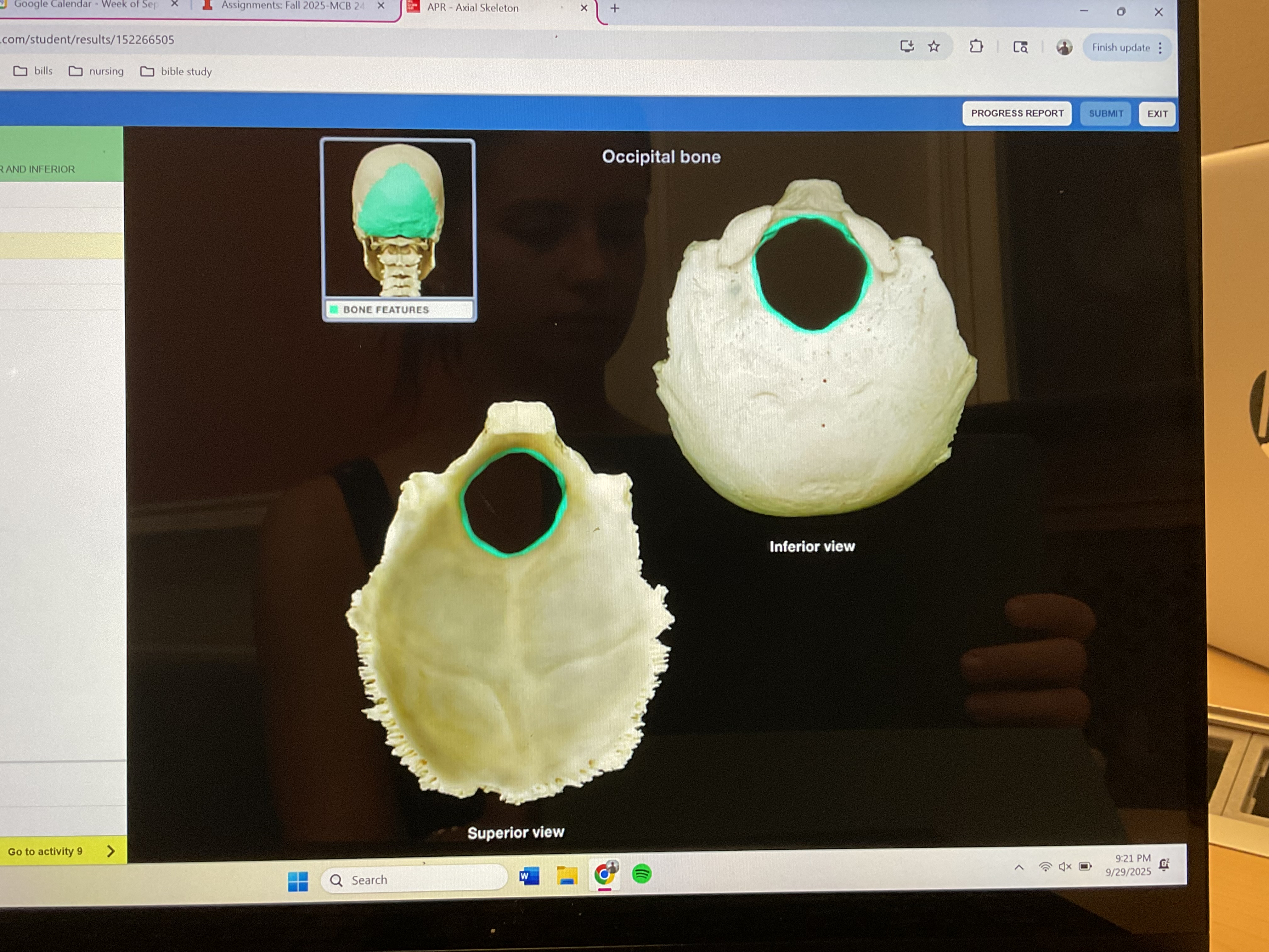 <p>Foramen magnum </p>