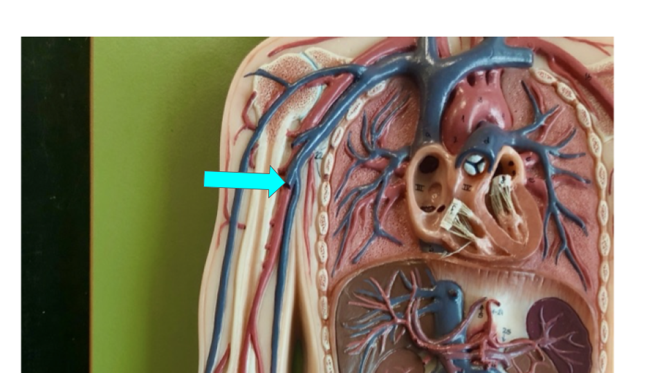 <p>(dissected — not fully shown)</p>