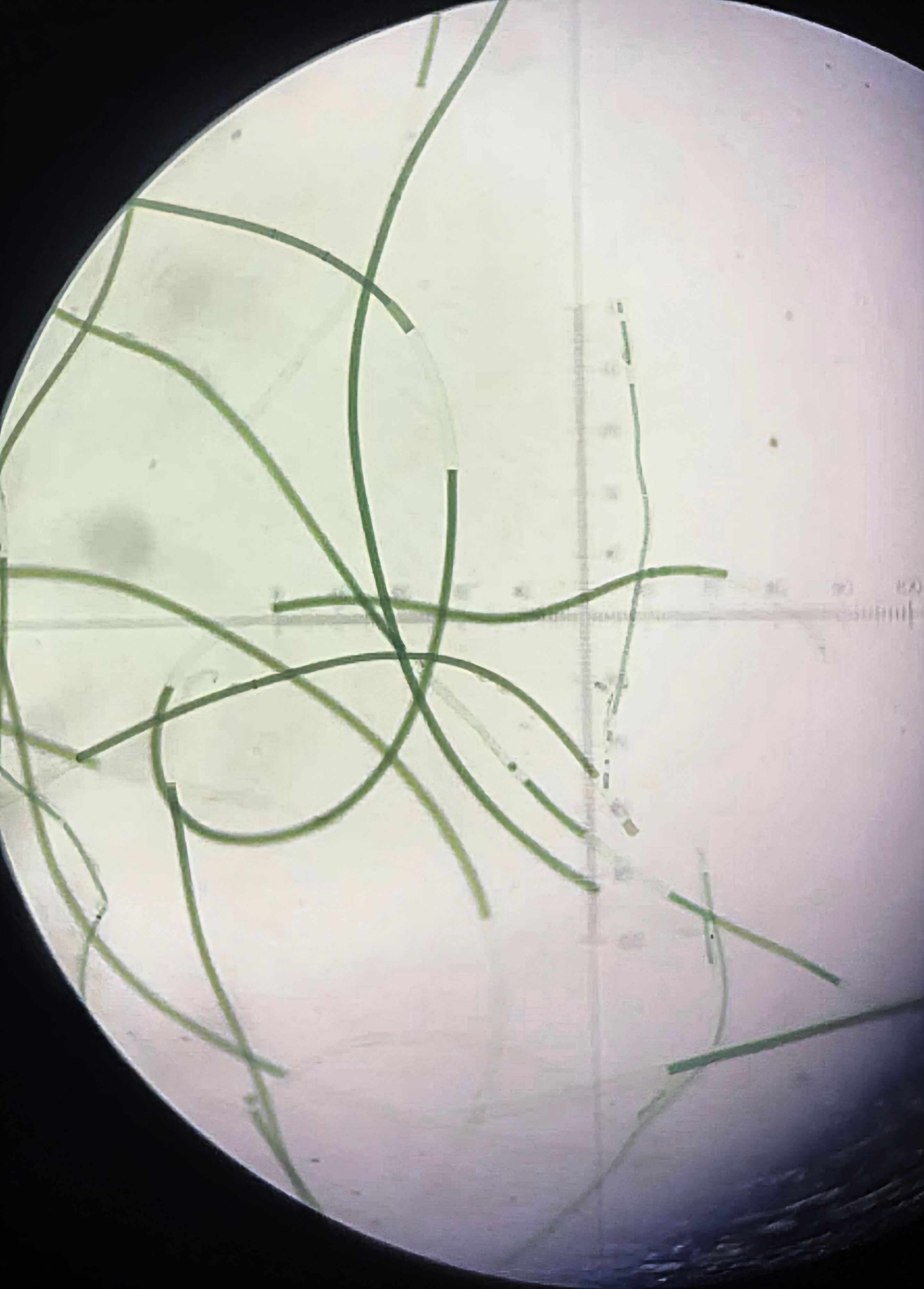 <p><strong><em>Oscillatoria</em></strong></p><p>Phylum: ?</p>