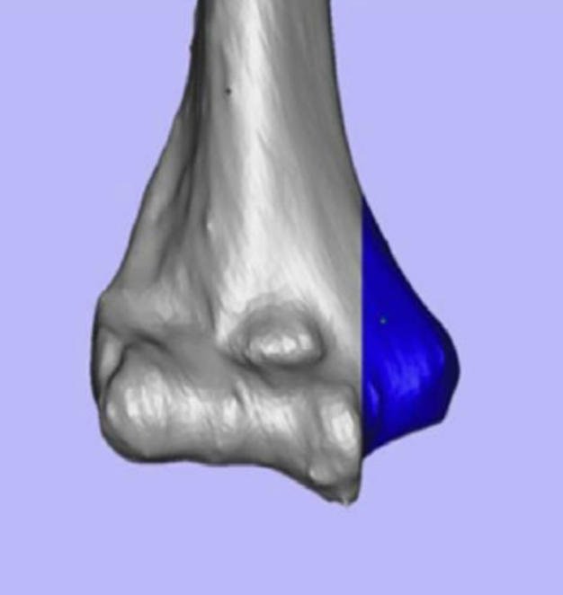 term image