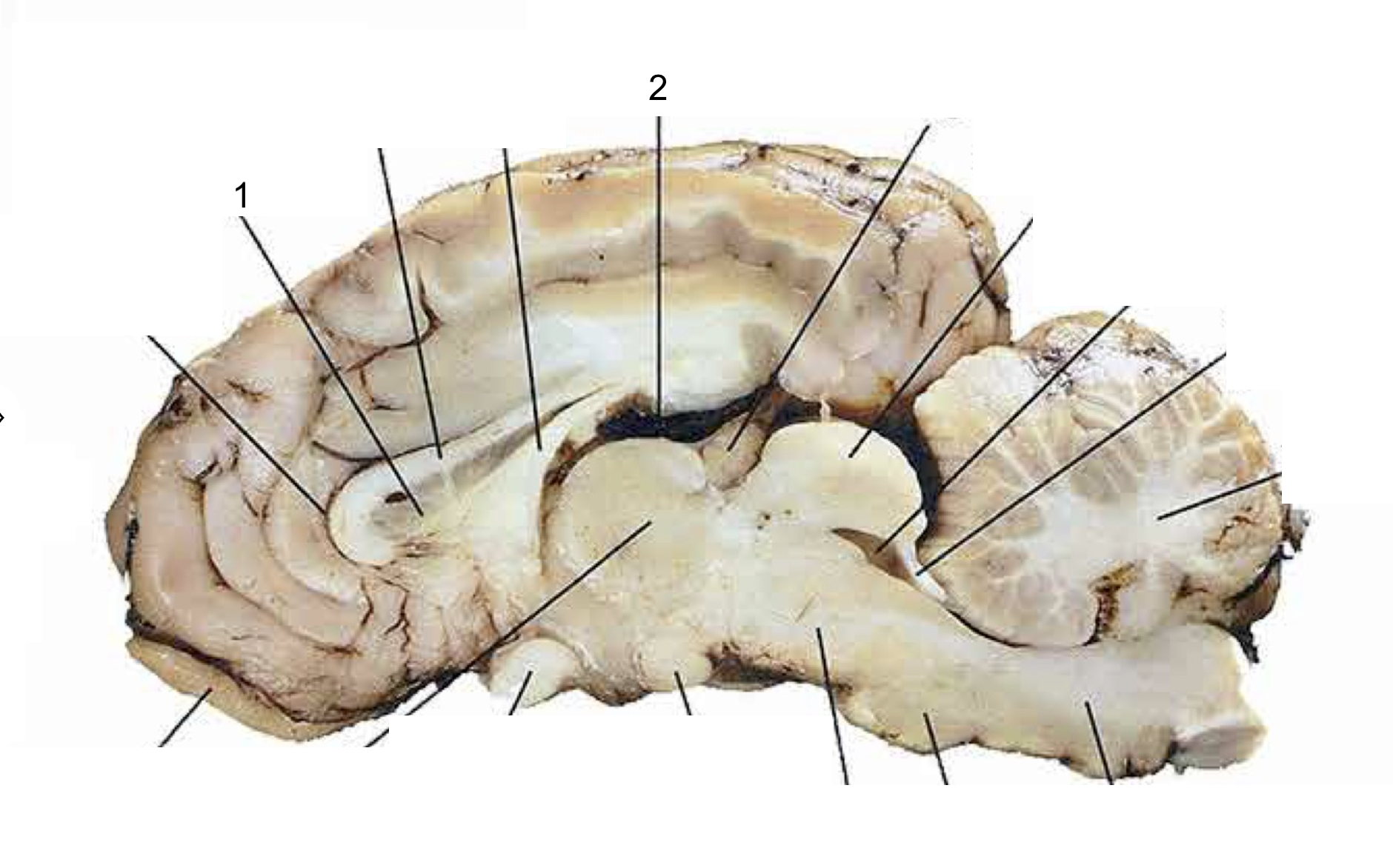 <p>What structure of the brain is this? #2</p>