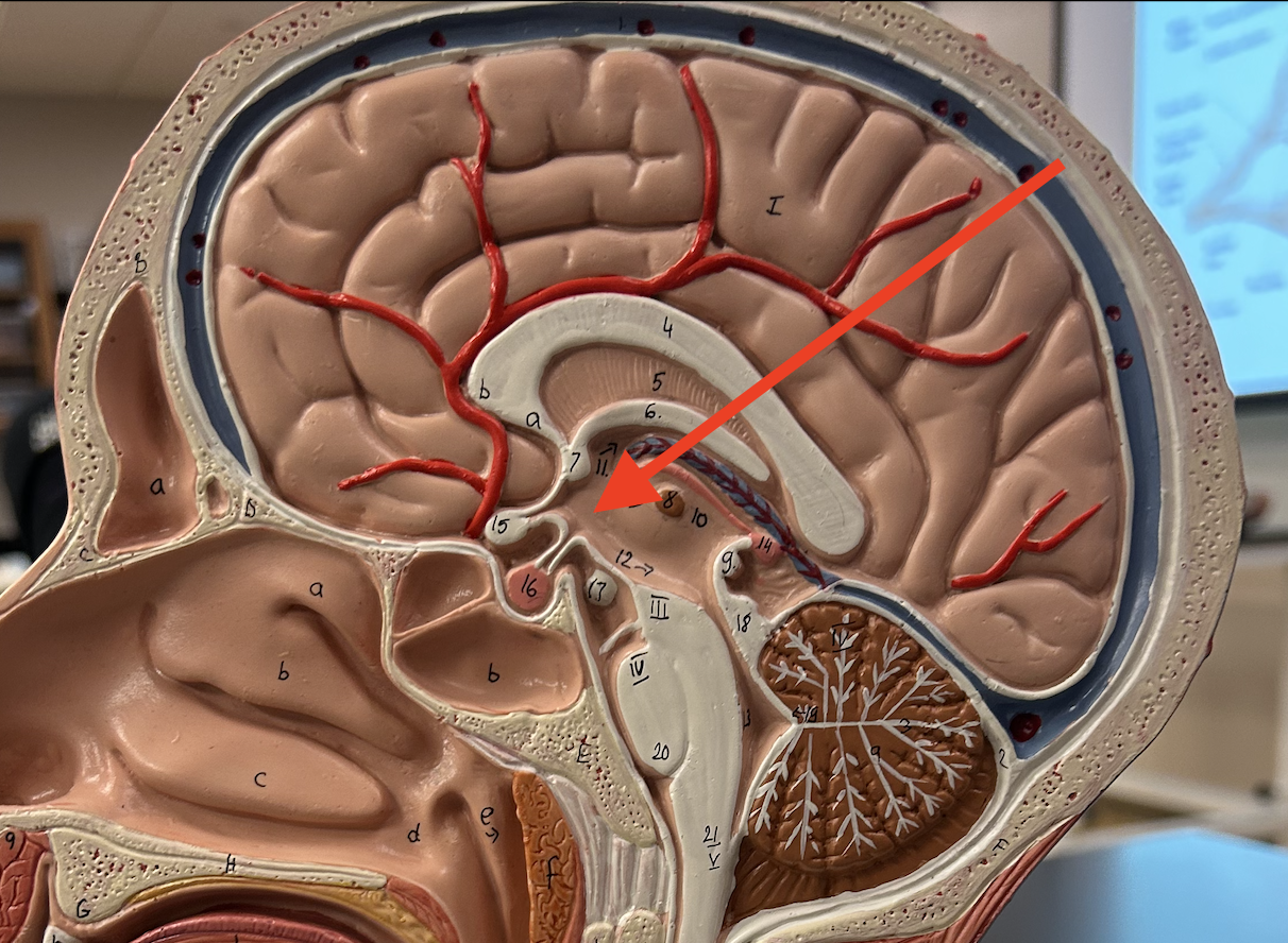 <p>name this structure, below thalamus</p>