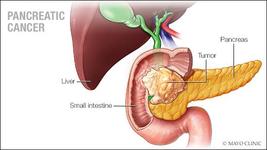 <p>HOMEOSTATIC IMBALANCE 2 pancreas </p>