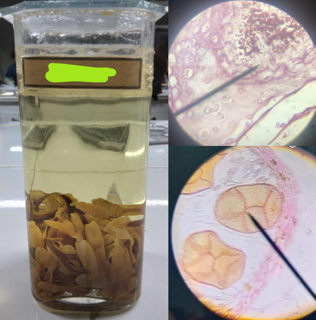 <p>a genus of brown algae found in the intertidal zones of rocky seashores almost throughout the world</p>