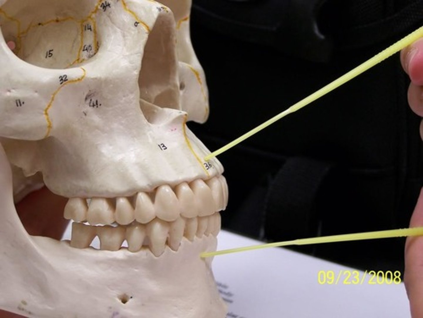 <p>Mandible/maxilla - tooth sockets</p>