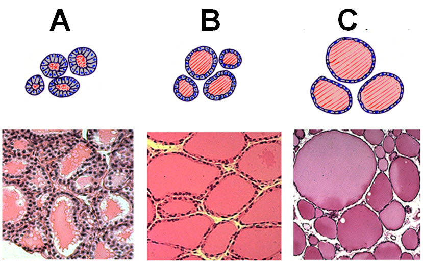 <p><span>Match the three lettered schemes and histological patterns of an organ with predicted blood levels of hormones.</span></p><p><span>a) normal thyroid hormone</span></p><p><span>b) elevated thyroid hormone</span></p><p><span>c) lowered thyroid hormone</span></p>