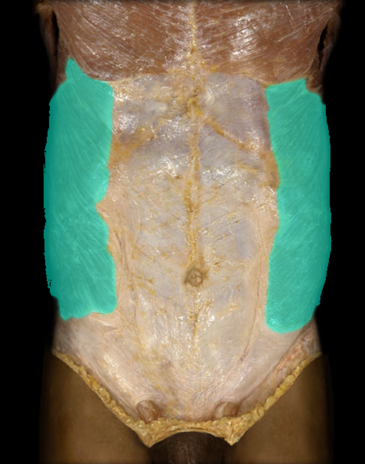 <p>A muscle that forms the outermost layer of the abdominal wall, involved in trunk rotation and lateral flexion. It originates from the lower eight ribs and inserts into the iliac crest and the linea alba. </p>