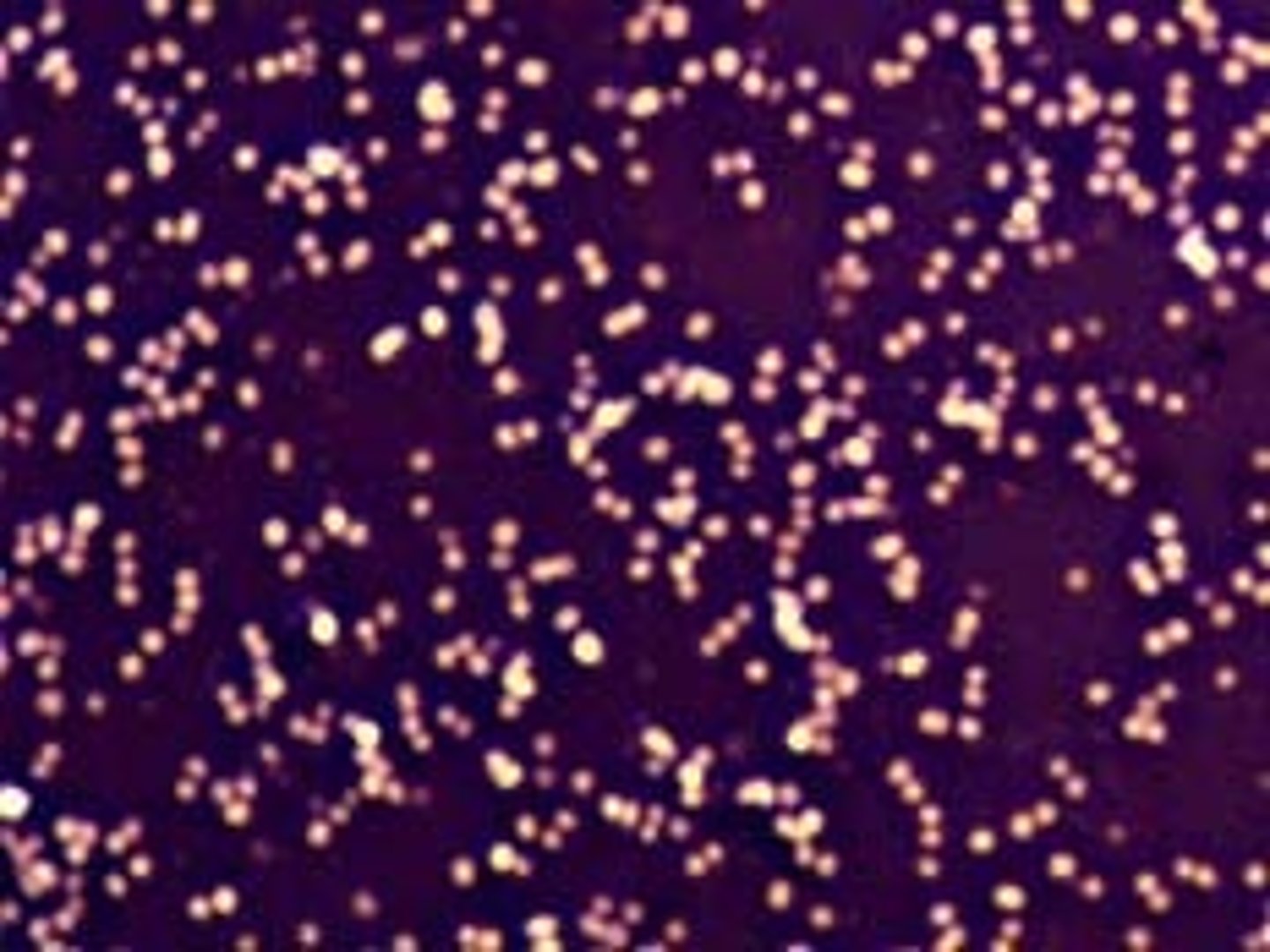 <p>uses acidic dye (negatively charged), which is repelled by (negatively charged0 cell walls, leaving clear cells on a dark background</p>