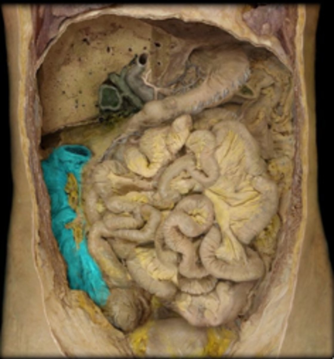 <p>Name this part of the large intestine.</p>