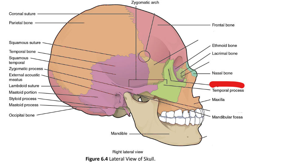 term image