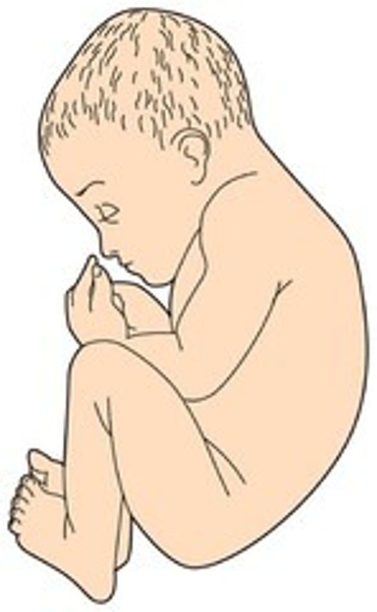 <p>-flexion</p><p>-head flexed toward the chest and the arms/legs flexed over the thorax</p><p>-back is curved in a convex C-shape</p>