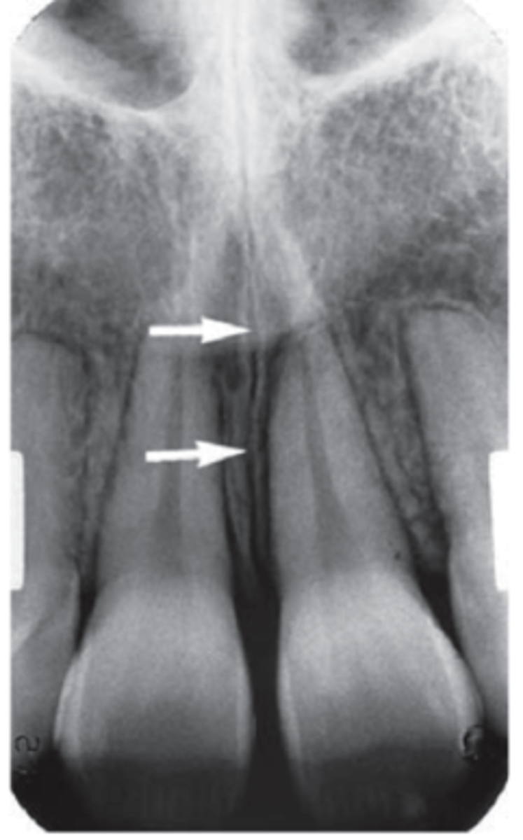 <p>ID the structure:</p>