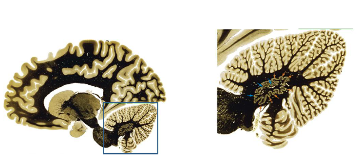 <p>The surface of the cerebellum is covered with folds called folia. The folia greatly increase the surface area of the cerebellar cortex</p>