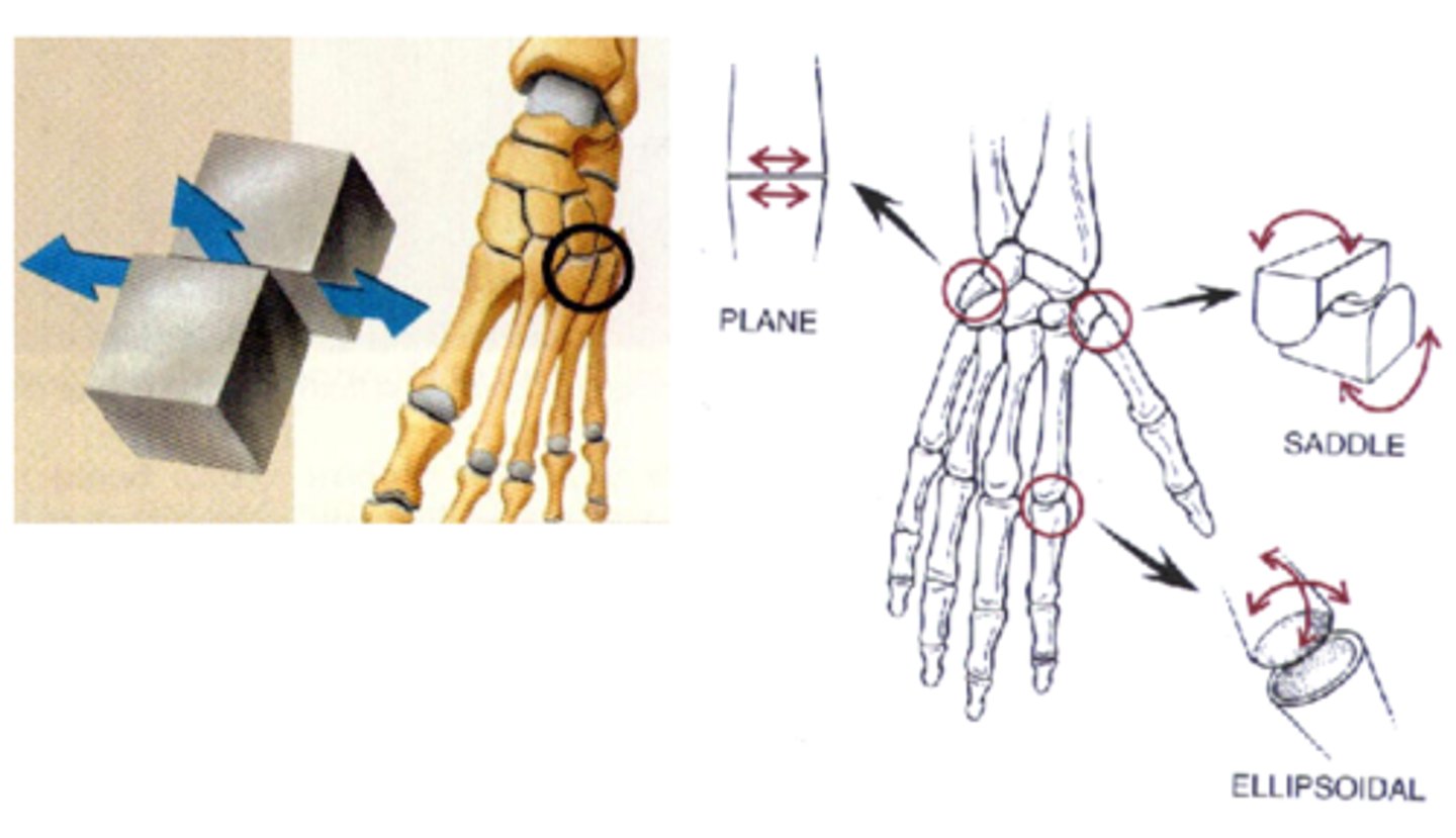<p>What type of joint is this?</p>