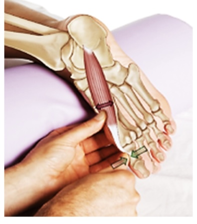 <p>abductor hallucis</p>