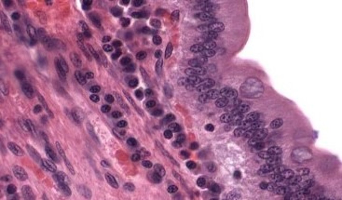 <p>small intestine</p>
