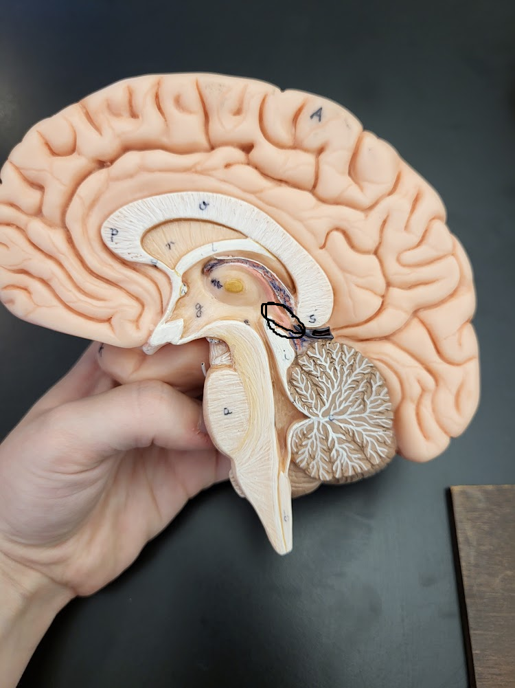 <p>pinecone shaped gland hanging from the roof of the third ventricle in the diencephalon</p>