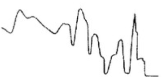 <p>SpO2 Waveform</p>