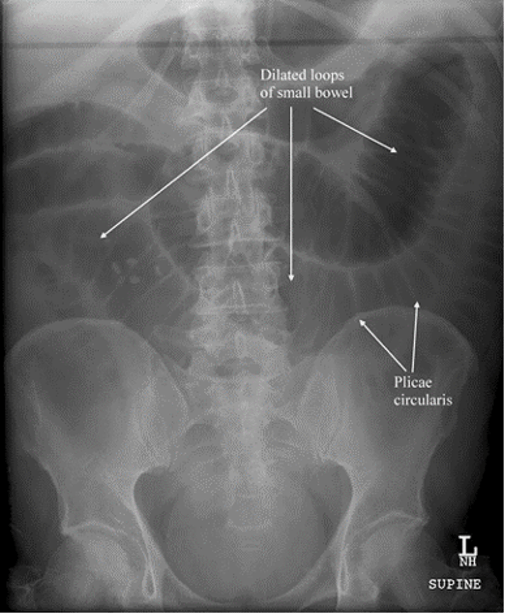 <p>ID</p>