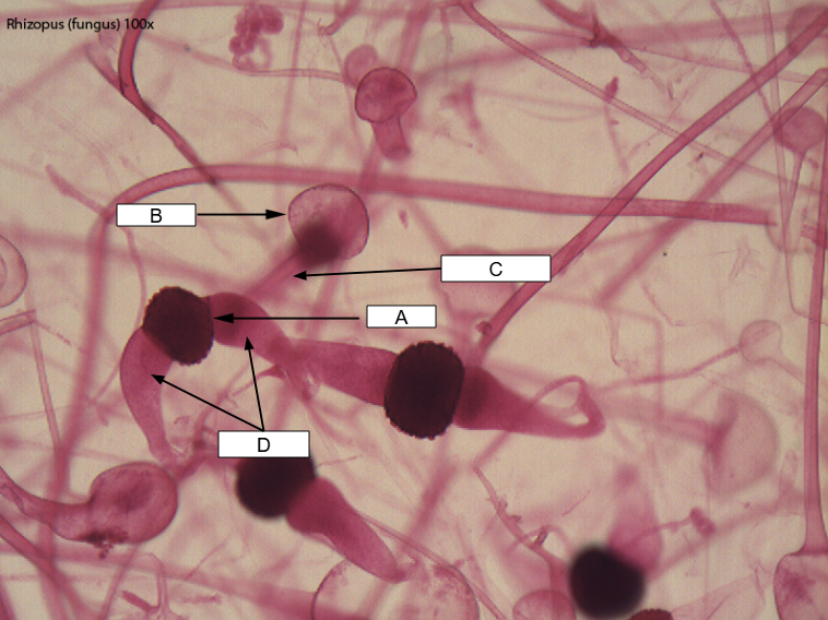 <p>What is this called</p>