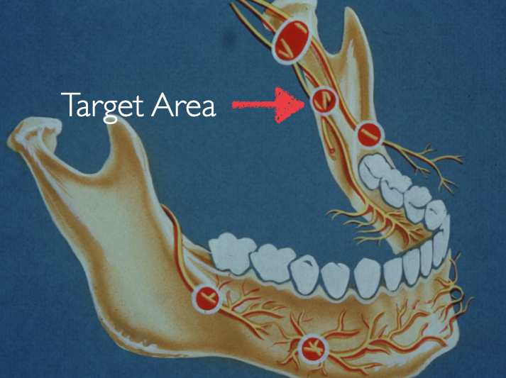 <p>(before mandibular foramen)</p>