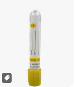 <p>Sterile Vacuum Tube for Urine</p>