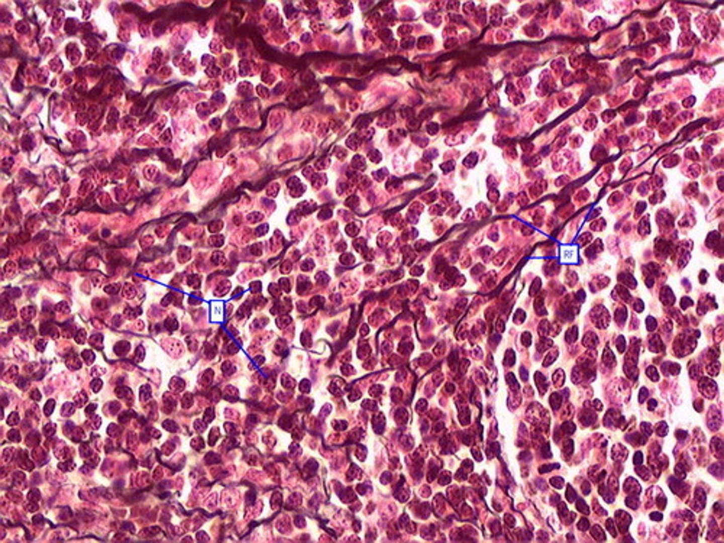 <p>-leukocytes</p><p>- reticular fibers</p><p>-fibroblasts</p>