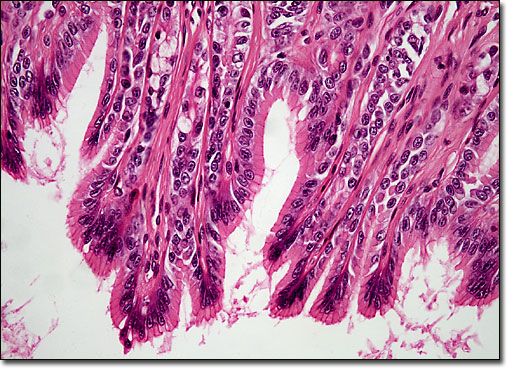 <p>What is the function of the epithelial tissue?</p>