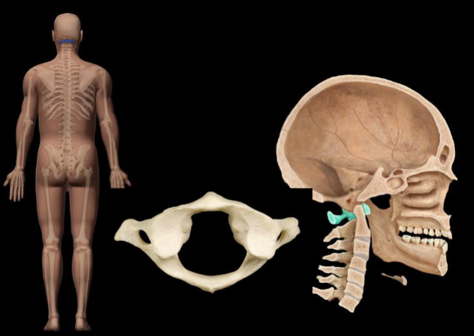 <p>What bone in the vertebral column is highlighted in this image?</p>