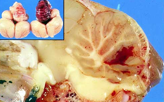 <p>7.&nbsp; Tissue from a turkey.&nbsp; Which of the following is NOT true?</p><p></p><ol><li><p>Vitamin E deficiency is the cause of avian encephalomyelitis.</p></li><li><p>Vitamin E prevents cellular damage by free radicals.</p></li><li><p>The causative lesion in affected poults is endothelial necrosis of capillaries.</p></li><li><p>Other lesions associated with Vitamin E deficiency are exudative diasthesis and nutritional myopathy.</p></li></ol><p></p>