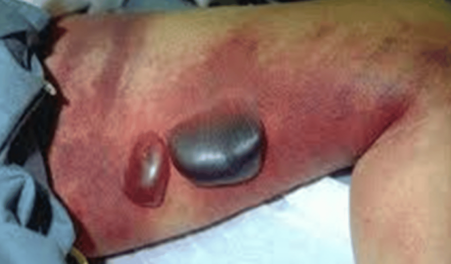 <p>What is the diagnosis?</p>