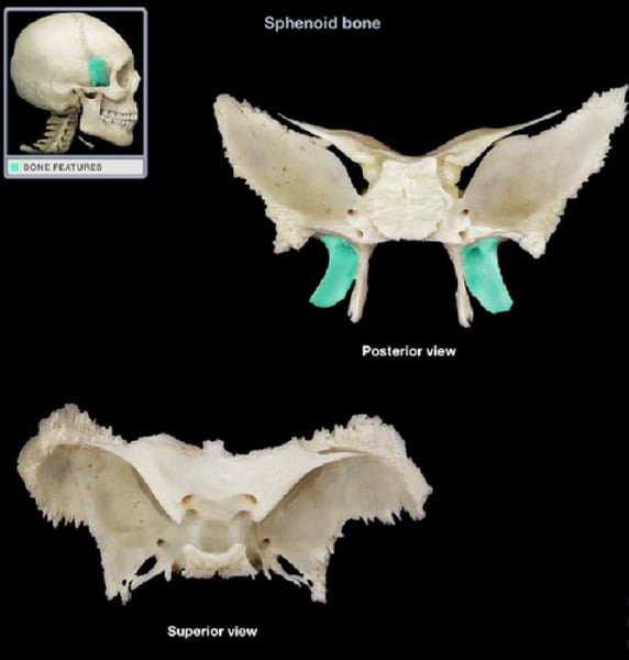 <p>sphenoid bone</p>