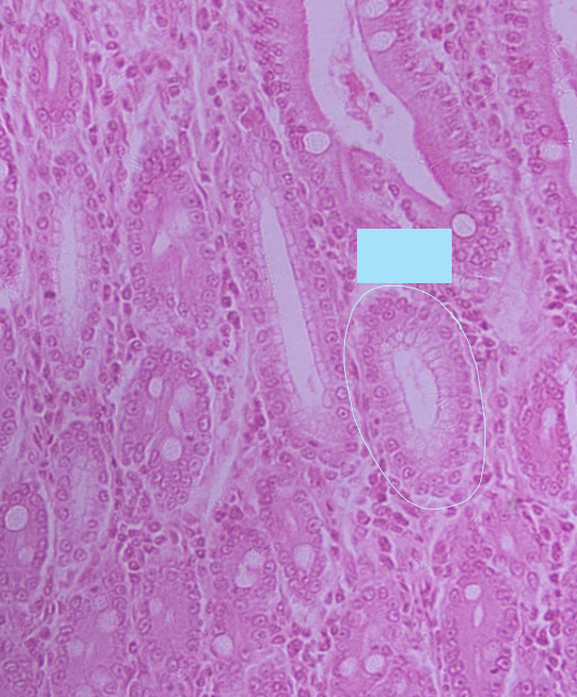 <p>what structure is circled in blue?</p>