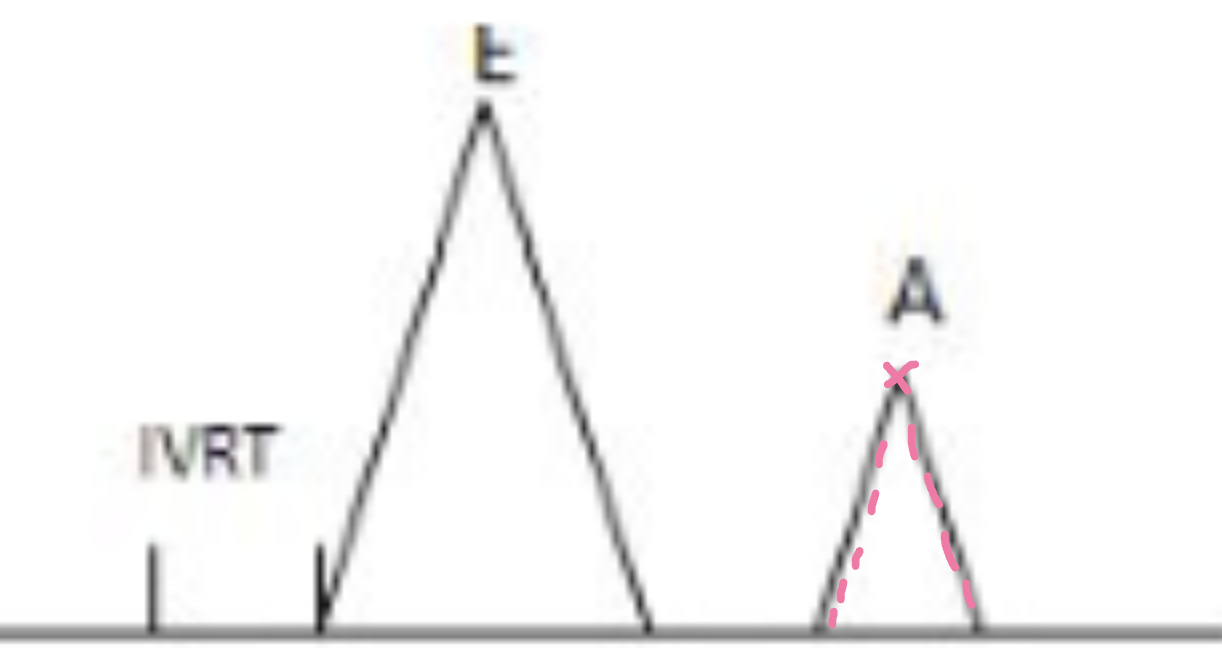 <p>LA contractility</p>