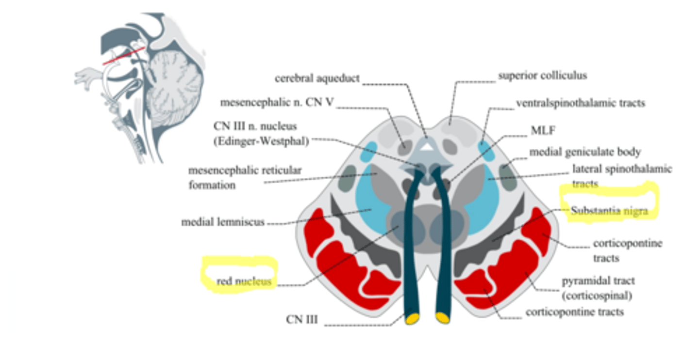 <p>- MELNĀ viela (substantia nigra) piedalās komplicētās motoriskās reakcijas;</p><p>- SARKANAIS kodols (nucleus ruber) kavē antigravitācijas ekstensoros (iztaisnošanās) refleksus.</p>