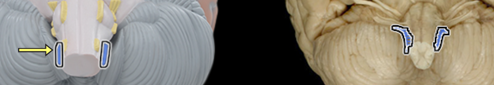 <p>Location:</p><ul><li><p>Vertebral canal (spinal root only)</p></li><li><p>Posterior cranial fossa</p></li><li><p>Neck</p></li></ul><p>Composition:</p><ul><li><p>Motor</p></li></ul><p>Motor:</p><ul><li><p>Cranial part: joins vagus nerve (CN X) to distribute to muscles of palate (except tensor veli palatini), pharynx (except stylopharyngeus), and larynx (intrinsic muscles)</p></li><li><p>Spinal part: trapezius and sternocleidomastoid</p></li></ul><p>CNS connection:</p><ul><li><p>Cranial root: medulla oblongata (nucleus ambiguous)</p></li><li><p>Spinal root: ventral horn of C1-4 spinal cord</p></li></ul><p>Cranial foramina:</p><ul><li><p>Foramen magnum (spinal root only)</p></li><li><p>Jugular foramen</p></li></ul><p>Comment:</p><ul><li><p>Cranial and spinal roots unite in jugular foramen to form accessory nerve</p></li><li><p>Cranial part of accessory nerve joins vagus nerve (CN X) and is distributed along its branches to muscles of palate, pharynx, and larynx</p></li><li><p>Accessory nerve also known as CN XI</p></li></ul><p></p>