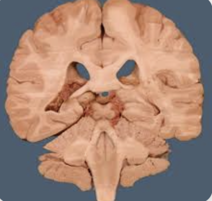 <p>Name this plane</p>