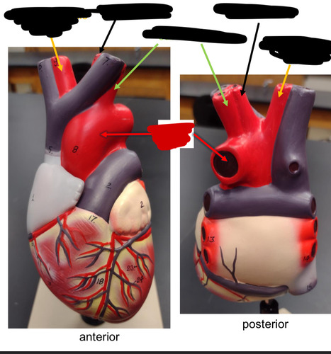<p>Name this heart vessel</p>