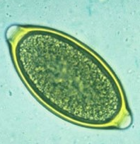 <p><em>Trichuris</em> spp. - whipworm (egg)</p>