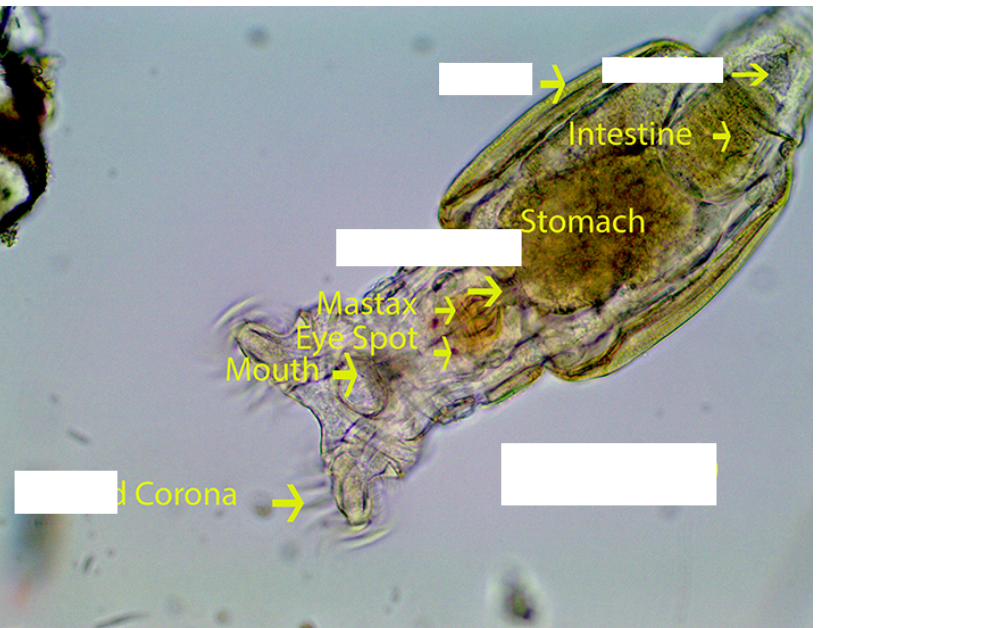 <p>Phylum Rotifera. <em>Philodina</em></p>
