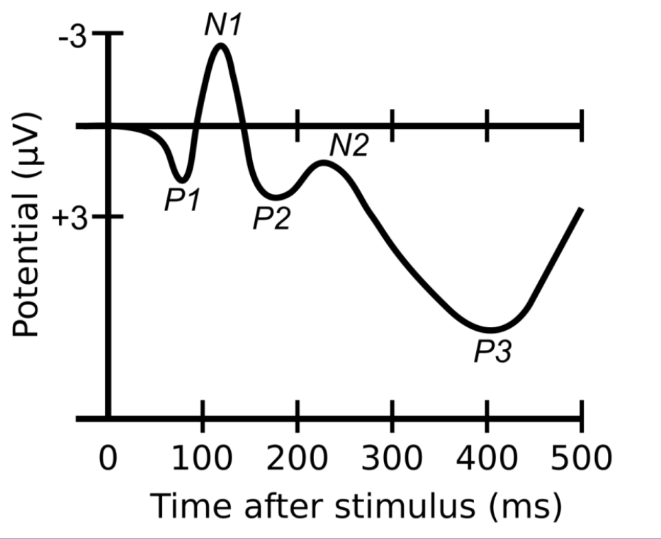 <p>Stimulus-linked changes in EEG activity.</p>