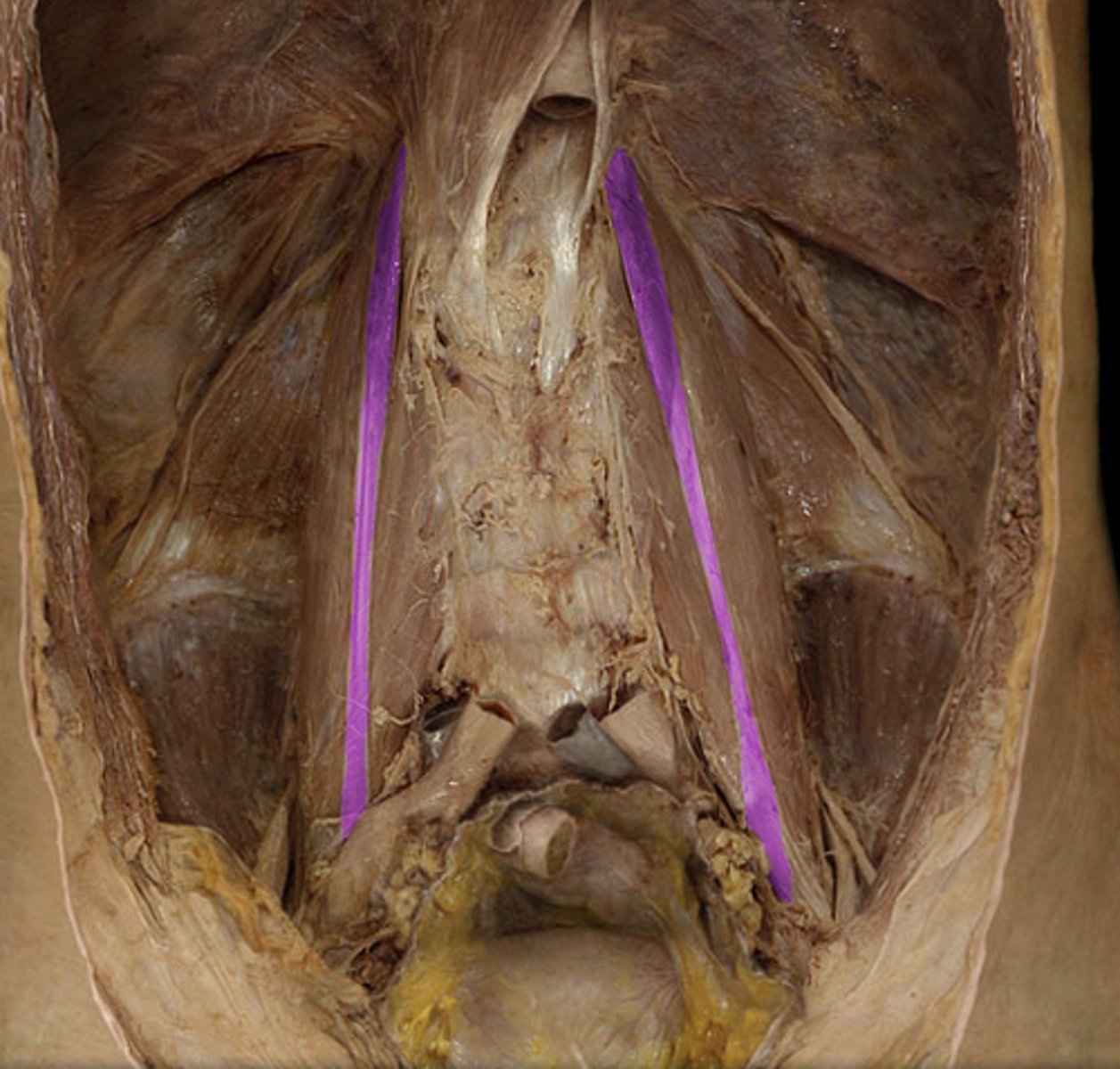 <p>muscle</p>
