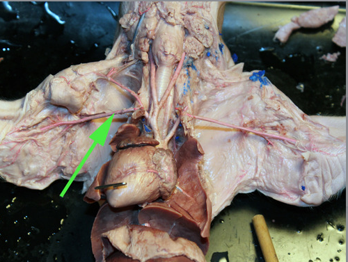 <p>The section of the artery marked by the green arrow is known as the <strong>Axillary </strong>artery.</p>