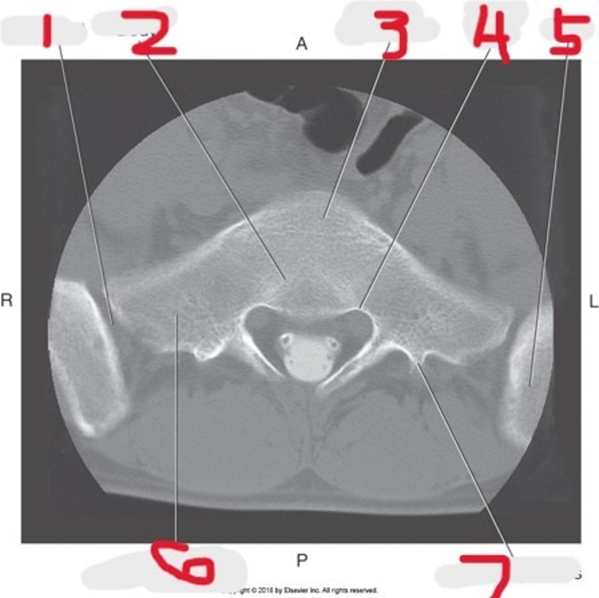 <p>Name all numbered structures</p>