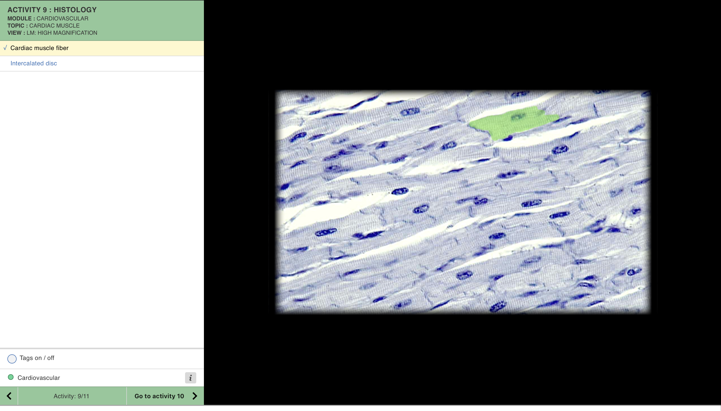 knowt flashcard image