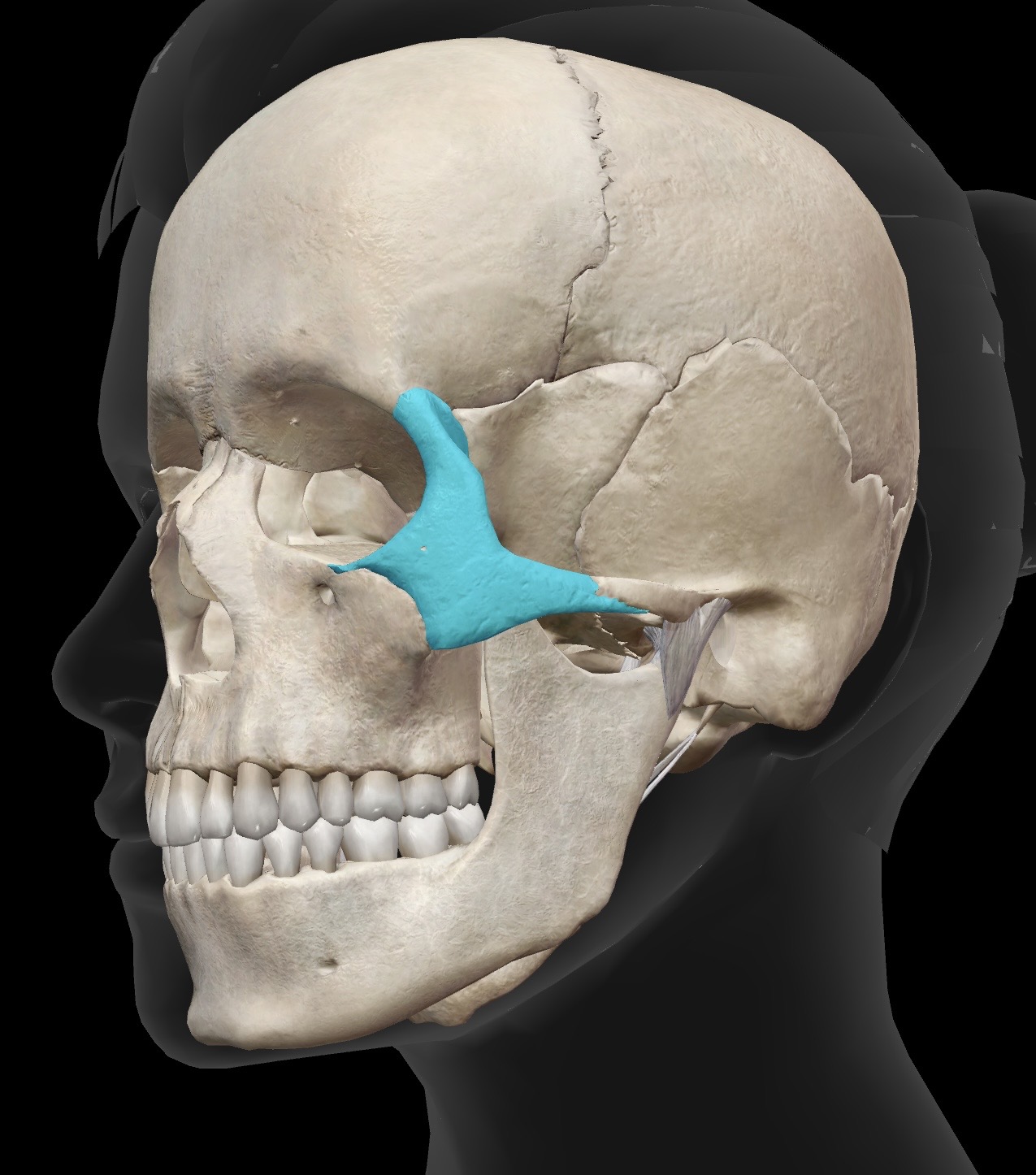 term image