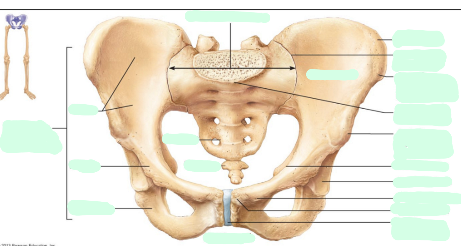 <p>Where is the <strong>acetabulum </strong>of the pubis?</p>