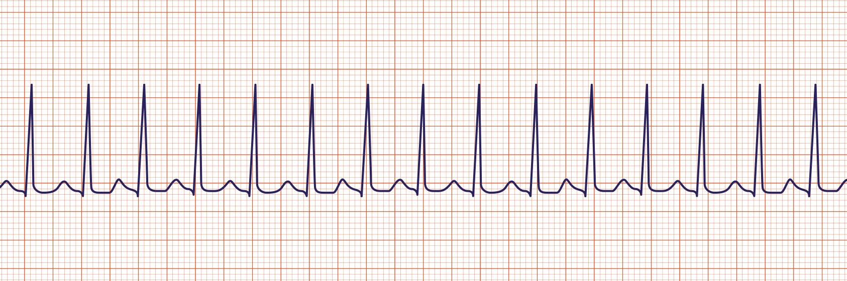 <p>What Rhythm is This?</p>