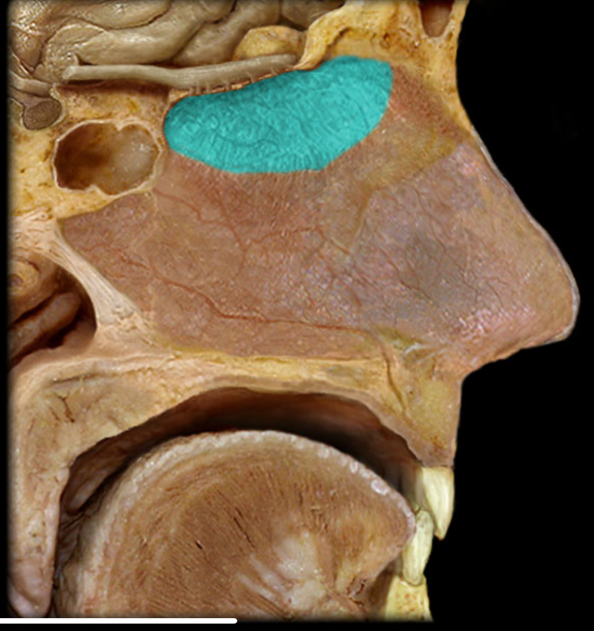 <h4 collapsed="false" seolevelmigrated="true"><strong>Location:</strong></h4><ul><li><p>Nasal cavity (superior nasal septum and superior nasal concha and roof between)</p></li></ul><h4 collapsed="false" seolevelmigrated="true"><strong>Description:</strong></h4><ul><li><p>Contains olfactory neurons</p></li></ul><h4 collapsed="false" seolevelmigrated="true"><strong>Comment:</strong></h4><ul><li><p>Primary function: olfaction</p></li></ul>